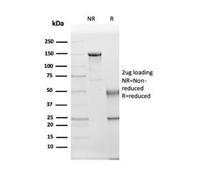 SDS-PAGE analysis of purified, BSA-free Kallikrein 5 antibody (clone KLK5/3844) as confirmation of integrity and purity.