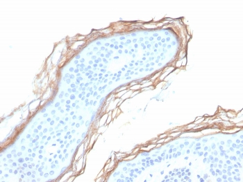 Kallikrein 5 Antibody Epidermal Keratinocyte IHC. Immunohistochemistry staining of FFPE human skin tissue with Kallikrein 5 antibody (clone KLK5/3855). HIER: boil tissue sections in pH 9 10mM Tris with 1mM EDTA for 20 min and allow to cool before testing.