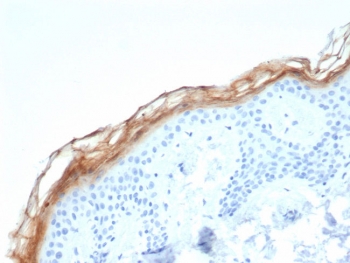 KLK7 Antibody immunohistochemistry analysis of Kallikrein 7 / KLK7 in human skin tissue. FFPE human skin tissue was stained with KLK7 antibody clone KLK7/4693 following heat induced epitope retrieval by boiling tissue sections in pH 9 Tris-EDTA buffer (10mM Tris, 1mM EDTA) for 20 minutes prior to cooling and staining. HRP-DAB brown chromogenic signal highlights strong staining in the outer epidermal layers near the stratum corneum, consistent with the known localization of Kallikrein 7 (KLK7), also referred to as stratum corneum chymotryptic enzyme, in differentiated keratinocytes involved in epidermal turnover and desquamation. Detection of KLK7 expression by immunohistochemistry supports studies of epidermal differentiation, keratinocyte biology, and skin barrier regulation using KLK7 Antibody / Kallikrein 7 (clone KLK7/4693).