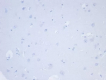 Negative control: IHC testing of FFPE human brain tissue with NAPSA antibody (clone NAPSA/7165R) at 2ug/ml. HIER: boil tissue sections in pH 9 10mM Tris with 1mM EDTA for 20 min and allow to cool before testing.