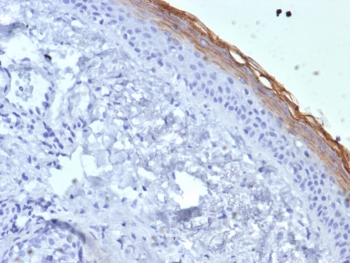 Kallikrein 7 Antibody immunohistochemistry analysis of KLK7 in human skin tissue using clone KLK7/4692. FFPE human skin tissue was stained with Kallikrein 7 antibody clone KLK7/4692 following heat induced epitope retrieval by boiling tissue sections in pH 9 Tris-EDTA buffer (10mM Tris, 1mM EDTA) for 20 minutes prior to cooling and staining. HRP-DAB brown chromogenic signal highlights strong staining along the outer epidermal layers near the stratum corneum, consistent with the known localization of Kallikrein 7 (KLK7), also known as stratum corneum chymotryptic enzyme, in differentiated keratinocytes involved in epidermal turnover and desquamation. Detection of KLK7 expression by immunohistochemistry supports studies of epidermal differentiation and keratinocyte biology using Kallikrein 7 Antibody / KLK7 (clone KLK7/4692).