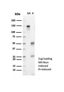 SDS-PAGE analysis of purified, BSA-free Kallikrein 7 antibody (clone KLK7/4692) as confirmation of integrity and purity.