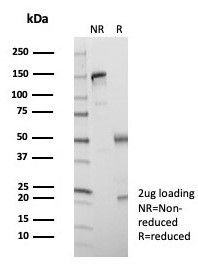 SDS-PAGE analysis of purified, BSA-free Kinesin-like protein 6 antibody (clone KIF2C/6524) as confirmation of integrity and purity.