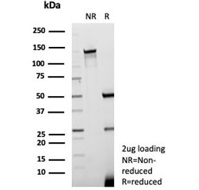 SDS-PAGE analysis of purified, BSA-free recombinant Kallikrein 7 antibody (clone KLK7/8971R) as confirmation of integrity and purity.