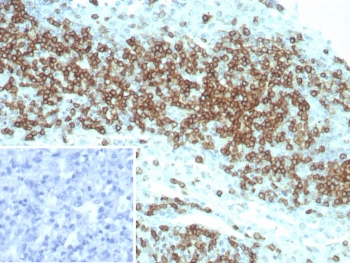 Immunohistochemistry analysis of CD2 antibody (clone LFA2/8845R) in human lymph node tissue. Formalin-fixed, paraffin-embedded lymph node shows strong membranous HRP-DAB brown staining in interfollicular T lymphocytes, consistent with CD2 expression on mature T cells. Follicular B cell areas display minimal staining, while hematoxylin counterstain highlights nodal architecture and nuclei. The inset shows PBS used in place of primary antibody as a negative control, confirming absence of non-specific secondary antibody binding. Heat-induced epitope retrieval was performed by boiling tissue sections in 10 mM Tris with 1 mM EDTA, pH 9.0, for 20 minutes followed by cooling at room temperature prior to staining.