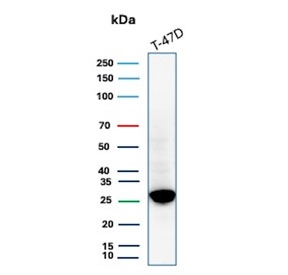 Western blot testing of human T-47D cell lysate with recombinant GSTM3 antibody (clone rGSTM3/8878).