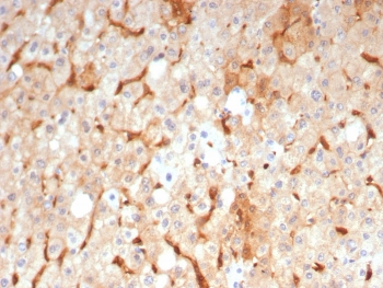 Guanylate Binding Protein 1 Antibody Liver IHC. Immunohistochemistry analysis of FFPE human liver tissue stained with Guanylate Binding Protein 1 Antibody clone GBP1/7617 demonstrates diffuse cytoplasmic and membranous HRP-DAB brown staining within hepatocyte-associated cellular populations, consistent with the role of Guanylate binding protein 1 / GBP1 in interferon-responsive inflammatory signaling and innate immune-associated stress response pathways. The observed staining pattern aligns with the function of GBP1 as an interferon-inducible GTPase involved in cytokine-responsive host defense and inflammatory activation. HIER: boil tissue sections in pH 9 10mM Tris with 1mM EDTA for 20 min and allow to cool before testing.