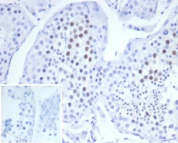 IHC staining of FFPE human testis tissue with Mitotic centromere associated kinesin antibody (clone KIF2C/6523) at 2ug/ml. Inset: PBS used in place of primary Ab (secondary Ab negative control). HIER: boil tissue sections in pH 9 10mM Tris with 1mM EDTA for 20 min and allow to cool before testing.