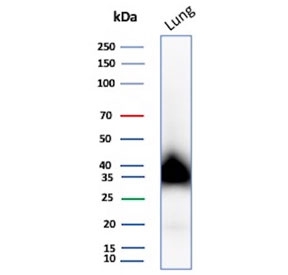 Western blot testing of human lung tissue lysate with recombinant PDPN antibody. Predicted molecular weight ~25 kDa but may be observed at higher molecular weights due to glycosylation.