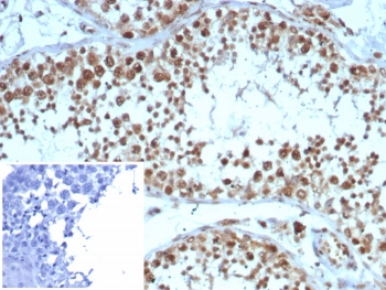 KIF2C Antibody Testis IHC. Immunohistochemistry analysis of Kinesin like protein 6 / KIF2C expression in FFPE human testis tissue using KIF2C Antibody, clone KIF2C/4705 at 2 ug/ml. The KIF2C Antibody shows strong nuclear and cytoplasmic HRP-DAB brown staining in spermatogenic cells within seminiferous tubules, while surrounding interstitial tissue displays reduced signal; nuclei are counterstained blue. Inset: PBS used in place of primary antibody to control for secondary antibody binding. This Microarray Specificity Validated Antibody supports highly specific detection of KIF2C in proliferative germ cell populations. Antigen retrieval was performed by boiling tissue sections in 10 mM Tris buffer with 1 mM EDTA, pH 9, for 20 min followed by cooling at room temperature.
