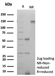 SDS-PAGE analysis of purified, BSA-free Op18 antibody (clone STMN1/8438) as confirmation of integrity and purity.