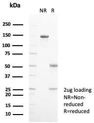 SDS-PAGE analysis of purified, BSA-free S100A9 antibody (clone S100A9/7550) as confirmation of integrity and purity.