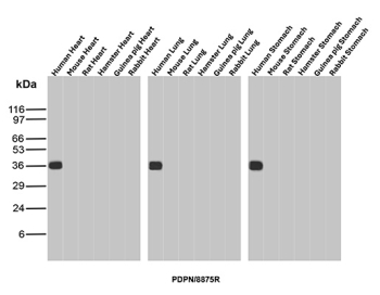 Glycoprotein 36 Antibody Cross-Species Tissue WB. Western blot analysis of Glycoprotein 36 / PDPN expression using recombinant antibody, clone PDPN/8875R. Lanes include human, mouse, rat, hamster, guinea pig, and rabbit tissue lysates from heart, lung, and stomach. A band is detected at approximately 36-40 kDa in human tissues, consistent with the predicted molecular weight of PDPN, while no comparable band is observed in the tested non-human species, supporting selective detection of human PDPN under these conditions.