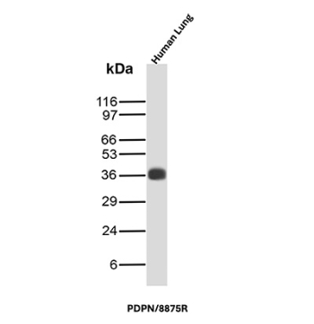 Glycoprotein 36 Antibody Lung WB. Western blot analysis of Glycoprotein 36 / PDPN expression in human lung tissue lysate using recombinant Glycoprotein 36 antibody, clone PDPN/8875R. Lane 1: human lung tissue lysate. A band is detected at approximately 36-40 kDa, consistent with the predicted molecular weight of PDPN, with migration influenced by glycosylation characteristic of this membrane-associated sialoglycoprotein.