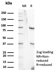 SDS-PAGE analysis of purified, BSA-free S100A9 antibody (clone S100A9/7553) as confirmation of integrity and purity.