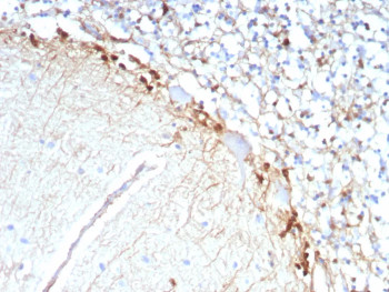 GLUL Antibody Recombinant Mouse MAb Brain IHC. Immunohistochemistry of GLUL Antibody Recombinant Mouse MAb rGLUL/8620 in human brain tissue. Formalin-fixed, paraffin-embedded human brain sections demonstrate cytoplasmic HRP-DAB brown staining in glial cell populations consistent with Glutamate-ammonia ligase (Glutamine synthetase) localization. Staining is observed along the neuropil and in astrocytic cell bodies, while neuronal nuclei remain unstained. Heat-induced epitope retrieval was performed by boiling tissue sections in pH 9 10 mM Tris with 1 mM EDTA for 20 min followed by cooling prior to antibody incubation.