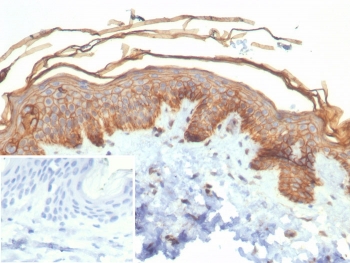 S100A16 Antibody Epidermal Layer IHC. Immunohistochemistry of S100 calcium binding protein A16 / S100A16 in FFPE human skin tissue using mouse monoclonal S100A16 antibody, clone S100A16/7411. HRP-DAB brown staining highlights strong cytoplasmic and membranous labeling of keratinocytes across the epidermal layers, consistent with epithelial differentiation, while underlying dermal components show minimal staining and nuclei are counterstained blue. Inset: PBS was used in place of primary antibody as a negative control to confirm specificity of staining. Heat induced epitope retrieval was performed by boiling tissue sections in pH 9 10 mM Tris with 1 mM EDTA for 20 min followed by cooling prior to staining.