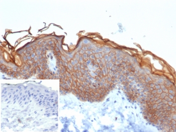 S100A16 Antibody Proliferative Epidermis IHC. Immunohistochemistry of S100 calcium binding protein A16 / S100A16 in FFPE human skin tissue using mouse monoclonal S100A16 antibody, clone S100A16/7412. HRP-DAB brown staining highlights prominent cytoplasmic and membranous labeling of keratinocytes within the epidermis, with increased intensity in basal and suprabasal layers consistent with proliferative and tumor-associated epithelial signaling, while the underlying dermis shows minimal staining and nuclei are counterstained blue. Inset: PBS was used in place of primary antibody as a negative control to confirm specificity of staining. Heat induced epitope retrieval was performed by boiling tissue sections in pH 9 10 mM Tris with 1 mM EDTA for 20 min followed by cooling prior to staining.