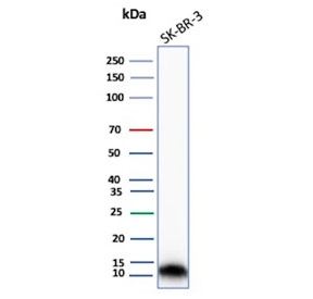 S100A16 Antibody Proliferation Marker WB. Western blot analysis of S100 calcium binding protein A16 / S100A16 in human SK-BR-3 cell lysate using S100A16 antibody, clone S100A16/7412. A band is detected at approximately 10-12 kDa, consistent with the predicted molecular weight of S100A16, supporting detection of this calcium-binding protein in proliferative epithelial-derived tumor cells.