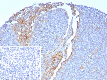CD64 Antibody Tonsil IHC. Immunohistochemistry staining of FFPE human tonsil with CD64 antibody (clone FCGR1A/7496) at 2ug/ml. Inset: PBS used in place of primary Ab (secondary Ab negative control). HIER: boil tissue sections in pH 9 10mM Tris with 1mM EDTA for 20 min and allow to cool before testing.
