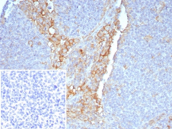 FCGR1A Antibody Tonsil IHC. Immunohistochemistry staining of FFPE human tonsil tissue with FCGR1A antibody (clone FCGR1A/7497) at 2ug/ml. Inset: PBS used in place of primary Ab (secondary Ab negative control). HIER: boil tissue sections in pH 9 10mM Tris with 1mM EDTA for 20 min and allow to cool before testing.