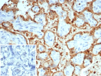 S100A12 Antibody / EN-RAGE Antibody (clone S100A12/4514) in human placental tissue. Immunohistochemistry staining of FFPE human placenta demonstrates cytoplasmic staining in scattered inflammatory cells consistent with the known expression of S100 calcium binding protein A12 / S100A12 in neutrophils and other myeloid-derived cells. Brown chromogenic signal highlights S100A12-positive inflammatory cells within placental tissue while surrounding trophoblastic and stromal cells remain largely negative. The inset shows PBS used in place of primary antibody as a secondary-only negative control. Heat-induced epitope retrieval was performed by boiling tissue sections in pH 9 Tris buffer with 1 mM EDTA for 20 min before staining.