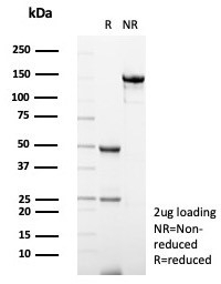 SDS-PAGE analysis of purified, BSA-free S100A12/EN-RAGE antibody (clone S100A12/4514) as confirmation of integrity and purity.