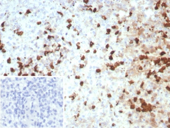 Calgranulin C Antibody (clone S100A12/8952R) in human spleen tissue. Immunohistochemistry staining of FFPE human spleen demonstrates cytoplasmic staining in scattered inflammatory cells consistent with the known expression of S100 calcium binding protein A12 / S100A12 in neutrophils and myeloid-derived cells. Brown chromogenic signal highlights S100A12-positive inflammatory cells within splenic tissue while surrounding lymphoid cells remain largely negative. The inset shows PBS used in place of primary antibody as a secondary-only negative control. Heat-induced epitope retrieval was performed by boiling tissue sections in pH 9 Tris buffer with 1 mM EDTA for 20 min before staining.
