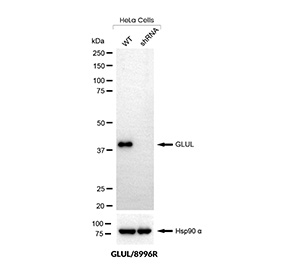 Glutamine Synthetase Antibody Knockdown Validation WB. Western blot analysis of GLUL expression in wild-type (WT) and GLUL shRNA knockdown HeLa cells using Glutamine Synthetase antibody clone GLUL/8996R. Lane 1: WT lysate, Lane 2: knockdown lysate. The band at approximately 40-45 kDa is reduced in knockdown cells, supporting target-specific detection. Hsp90 alpha serves as a loading control.