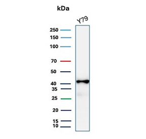Glutamine Synthetase Antibody Y79 Cell WB. Western blot analysis of GLUL expression in human Y79 cell lysate using Glutamine Synthetase antibody clone GLUL/8996R. A band is observed at approximately 40-45 kDa, consistent with expected protein size.