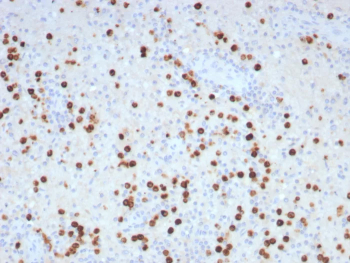 Glutamine Synthetase Antibody Brain IHC Astrocyte Pattern. Immunohistochemical staining of human brain FFPE tissue with Glutamine Synthetase antibody clone GLUL/8996R shows cytoplasmic labeling of glial cells with characteristic distribution across neural tissue, reflecting metabolic support functions in the central nervous system.