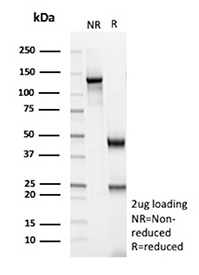 Glutamine Synthetase Antibody SDS-PAGE (Reducing vs Non-Reducing). SDS-PAGE analysis of Glutamine Synthetase antibody clone GLUL/8996R under reducing (R) and non-reducing (NR) conditions, demonstrating expected antibody heavy and light chain band patterns.