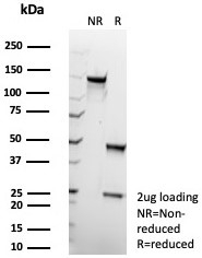 SDS-PAGE analysis of purified, BSA-free GLUL antibody (clone GLUL/8517R) as confirmation of integrity and purity.