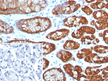 Immunohistochemistry of GLUL Antibody Recombinant Rabbit MAb GLUL/8256R in human brain tissue. Formalin-fixed, paraffin-embedded human brain sections demonstrate cytoplasmic HRP-DAB brown staining consistent with Glutamate-ammonia ligase (Glutamine synthetase) expression. Positive staining is observed within glial cell populations distributed throughout the neuropil, while neuronal nuclei remain unstained. The inset panel shows PBS used in place of primary antibody as a negative control with minimal background signal. Heat-induced epitope retrieval was performed by boiling tissue sections in pH 9 10 mM Tris with 1 mM EDTA for 20 min followed by cooling prior to antibody incubation.