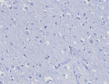 Negative control: IHC testing of FFPE human brain tissue with CD45RA antibody (clone PTPRC/8124R) at 2ug/ml. HIER: boil tissue sections in pH 9 10mM Tris with 1mM EDTA for 20 min and allow to cool before testing.