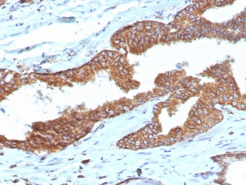 Immunohistochemistry analysis of Cyclooxygenase 2 / COX2 antibody (clone COX2/7803R) in human prostate tissue. FFPE human prostate shows strong cytoplasmic and membranous staining in glandular epithelial cells, consistent with COX2 expression in prostatic epithelium, while surrounding stromal cells demonstrate minimal background signal. Antigen retrieval was performed by boiling tissue sections in pH 9, 10mM Tris with 1mM EDTA for 20 minutes followed by cooling prior to staining.