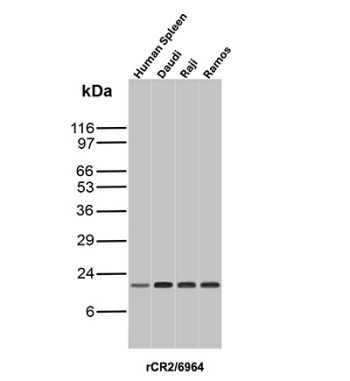 CD21 Antibody B-cell Line WB. Western blot analysis of Complement Receptor 2 / CD21 in human spleen, Daudi, Raji, and Ramos lysates using recombinant mouse monoclonal CD21 antibody, clone rCR2/6964. A band is detected at approximately 20â25 kDa in all samples, consistent with the expected molecular weight of CD21 fragments, with strong signal observed in B-cell lymphoma lines reflecting CD21 expression in B-cell populations.