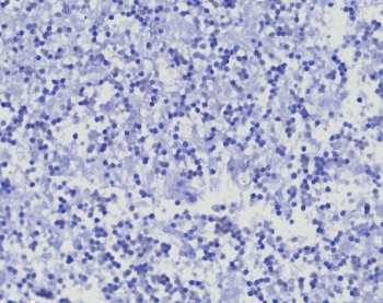 Negative control: IHC testing of FFPE human brain tissue with CD45RA antibody (clone PTPRC/8341R) at 2ug/ml. HIER: boil tissue sections in pH 9 10mM Tris with 1mM EDTA for 20 min and allow to cool before testing.
