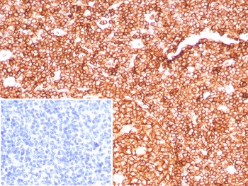 Immunohistochemistry analysis of CD45RA antibody (clone PTPRC/8699R) in human tonsil tissue. FFPE human tonsil demonstrates strong membranous staining of lymphoid cells within follicular and interfollicular regions, consistent with CD45RA surface expression. The inset negative control, using PBS in place of the primary antibody, shows no specific staining. Heat-induced epitope retrieval was performed by boiling sections in pH 9 10mM Tris with 1mM EDTA for 20 minutes followed by cooling prior to staining.
