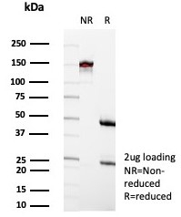 SDS-PAGE analysis of purified, BSA-free CD35 antibody (clone rCR1/8600) as confirmation of integrity and purity.