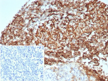 IHC staining of FFPE human tonsil tissue with CD35 antibody (clone CD35/8674R) at 2ug/ml. Inset: PBS used in place of primary Ab (secondary Ab negative control). HIER: boil tissue sections in pH 9 10mM Tris with 1mM EDTA for 20 min and allow to cool before testing.