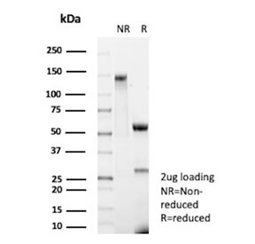 SDS-PAGE analysis of purified, BSA-free CD35 antibody (clone CR1/8674R) as confirmation of integrity and purity.