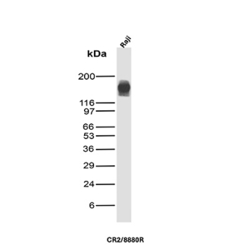 CD21 Antibody Raji WB. Western blot analysis of Complement Receptor 2 / CD21 in human Raji cell lysate using recombinant rabbit monoclonal CD21 antibody, clone CR2/8880R. A band is detected at approximately 140-150 kDa, consistent with the predicted molecular weight of full-length CD21 and reflecting its expression in B-cell lymphoma cells.