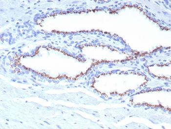 SLC45A3 Antibody for IHC. Immunohistochemistry analysis of Prostein / SLC45A3 antibody staining in FFPE human prostate tissue using clone SLC45A3/7653. Strong cytoplasmic and perinuclear staining is observed in prostate glandular epithelial cells outlining luminal structures, consistent with Golgi-associated localization of Prostein, while surrounding stromal components remain largely negative. The staining highlights polarized epithelial organization and secretory cell morphology within prostate glands, supporting the role of SLC45A3 as a Golgi-associated protein involved in intracellular trafficking in prostate epithelium. Heat-induced epitope retrieval was performed in pH 9 Tris-EDTA buffer for 20 minutes followed by cooling prior to antibody incubation.