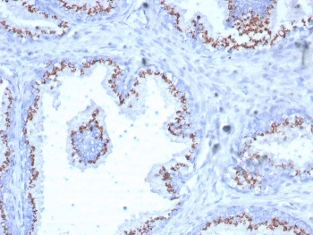 Solute carrier family 45 member 3 Antibody for IHC. Immunohistochemistry analysis of SLC45A3 / Prostein antibody staining in FFPE human prostate tissue using clone SLC45A3/7649. Strong cytoplasmic and perinuclear staining is observed in prostate glandular epithelial cells outlining luminal structures, consistent with Golgi-associated localization of SLC45A3 as a solute carrier transport protein, while surrounding stromal cells remain negative. The staining highlights epithelial cell polarity and intracellular compartmentalization within the secretory pathway, reflecting the transport-associated role of SLC45A3 in prostate epithelial cells. Heat-induced epitope retrieval was performed in pH 9 Tris-EDTA buffer for 20 minutes followed by cooling prior to antibody incubation.