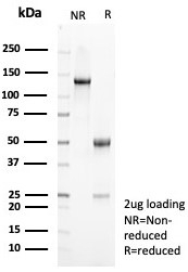 SDS-PAGE analysis of purified, BSA-free Interleukin 10 antibody (clone IL10/8711) as confirmation of integrity and purity.