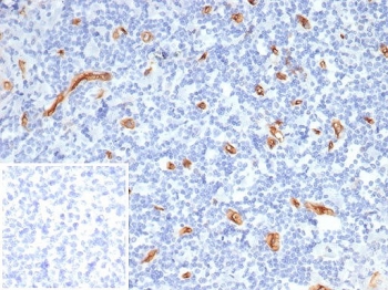 IHC staining of FFPE human tonsil tissue with CD34 antibody (clone CD34/7721). Inset: PBS used in place of primary Ab (secondary Ab negative control). HIER: boil tissue sections in pH 9 10mM Tris with 1mM EDTA for 20 min and allow to cool before testing.