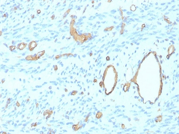 CD34 Antibody Uterus IHC rHPCA1/8500. Immunohistochemistry analysis of CD34 expression in FFPE human uterus tissue using a Microvessel Density Marker Antibody, clone rHPCA1/8500, demonstrates distinct membranous HRP-DAB brown staining in endothelial cells outlining capillaries and small vessels, enabling clear identification and enumeration of microvascular structures within the tissue, while surrounding stromal and epithelial cells remain largely negative. The staining pattern supports accurate assessment of microvessel density and vascular distribution. HIER: boil tissue sections in pH 9 10mM Tris with 1mM EDTA for 20 min and allow to cool before testing.