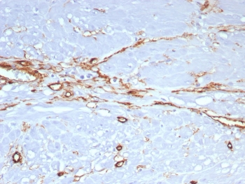 CD34 Antibody Stomach IHC rHPCA1/8573. Immunohistochemistry analysis of CD34 expression in FFPE human stomach tissue using a Tumor Angiogenesis Marker Antibody, clone rHPCA1/8573, reveals membranous HRP-DAB brown staining in endothelial cells forming elongated and interconnected vascular structures within the stromal compartment, while gastric epithelial cells remain largely negative. The staining pattern highlights irregular vascular networks and supports visualization of angiogenic remodeling within gastric tissue. HIER: boil tissue sections in pH 9 10mM Tris with 1mM EDTA for 20 min and allow to cool before testing.