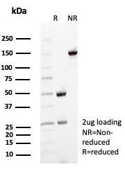 SDS-PAGE analysis of purified, BSA-free CD35 antibody (clone rCR1/8597) as confirmation of integrity and purity.